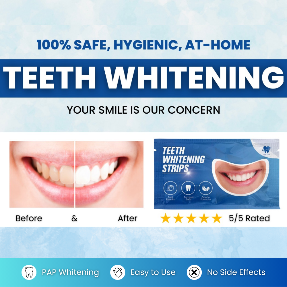 Teeth Whitening Strips (14 Treatments with 28 Strips)